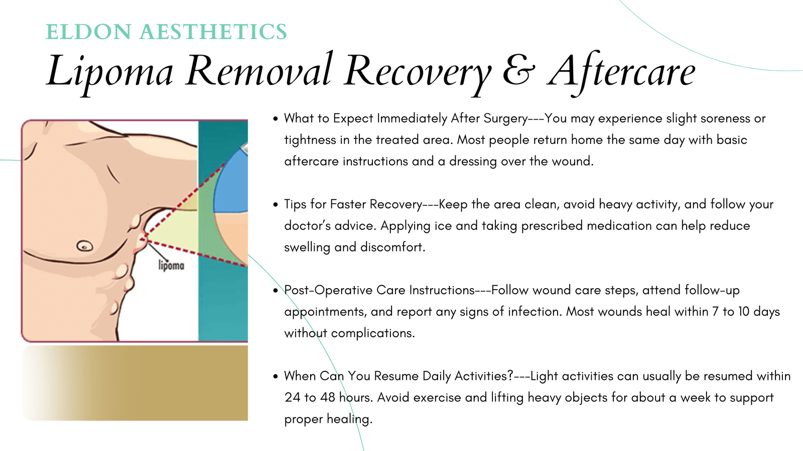 Lipoma Removal Recovery & Aftercare