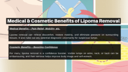 Medical & Cosmetic Benefits of Lipoma Removal