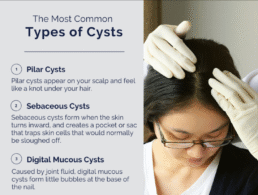 Types of Cysts