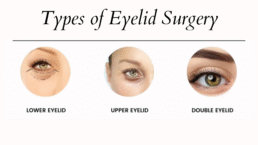 types of cosmetic eyelid surgery